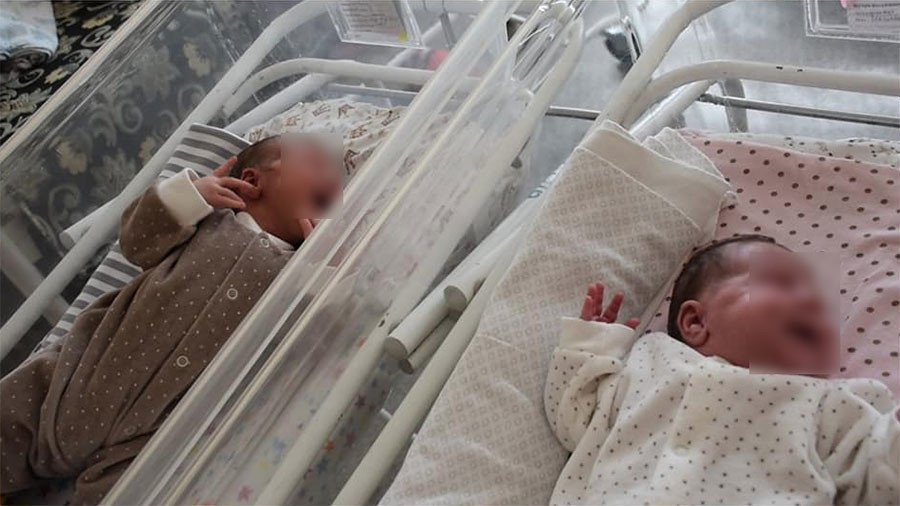 Жена роди близнаци с разлика от... 2,5 месеца 