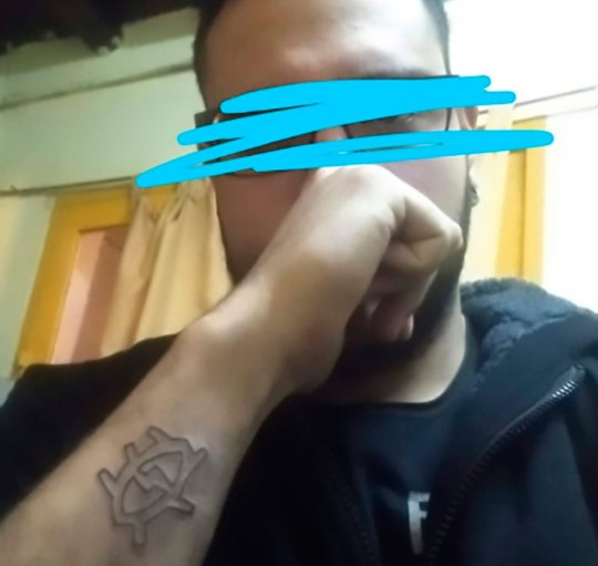 Мъж си "изтри" татуировката с ренде СНИМКИ 18+