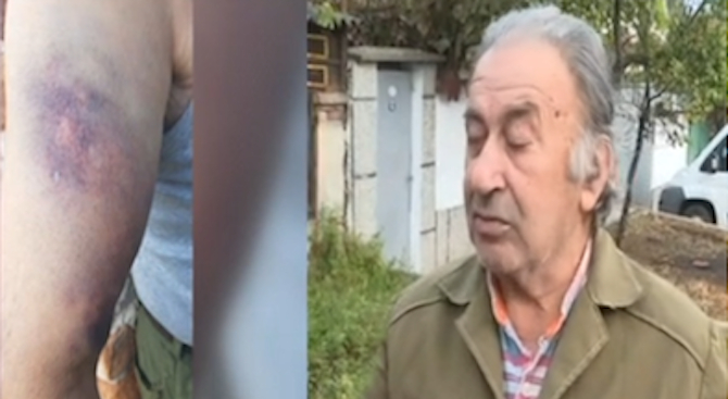Цигани пребиха брутално старци в Бузовград СНИМКИ