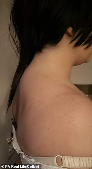 Лесбийка се оплака от непоносим живот заради огромните ѝ гърди СНИМКИ 18+