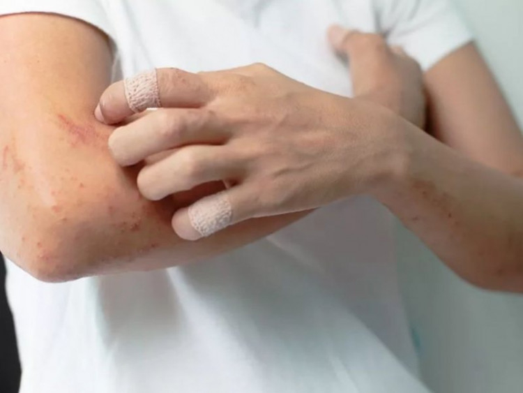Дерматолог обясни защо безпричинният сърбеж на кожата е опасен