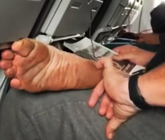 Отврат: Гнусен пътник си къса кожа от крака по време на полет ВИДЕО