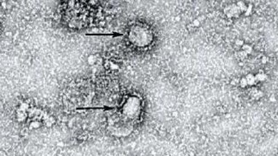 Плашеща СНИМКА на смъртоносния коронавирус