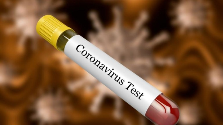 От ВМА с последни новини за изследваните проби за коронавирус