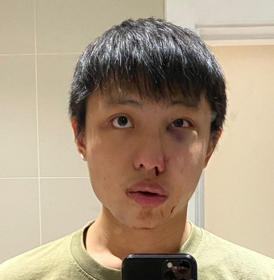 Студент от Сингапур стана жертва на брутална жестокост насред Лондон заради коронавируса