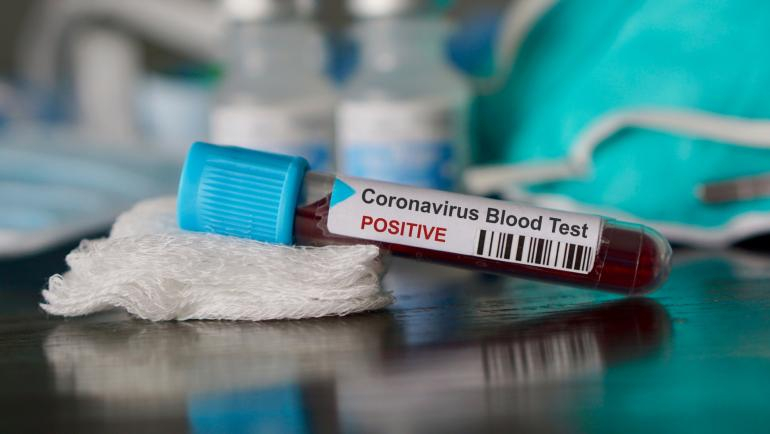 Тревожна информация за заразения с коронавирус в Плевен 