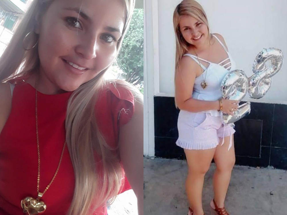 Кожата на блондинка почерня след липосукция, младата майка умря за 3 дни СНИМКИ