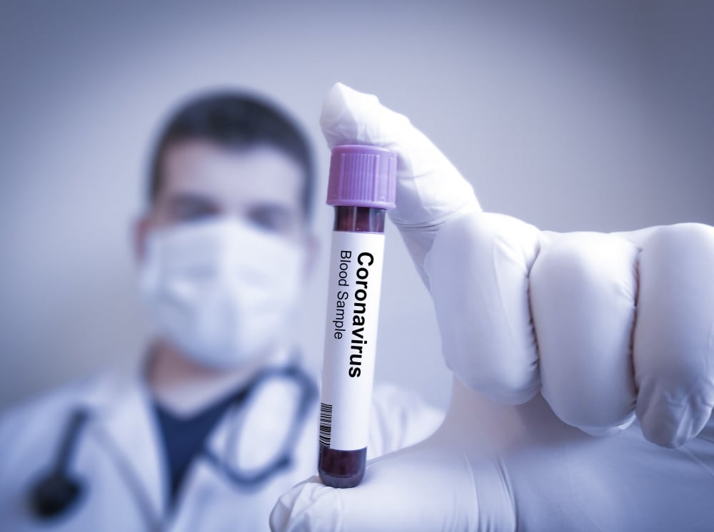 От ВМА огласиха резултатите от 8-те съмнителни проби за коронавирус! 