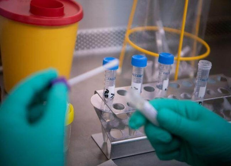 Лабораториите в пълен колапс заради коронавируса 