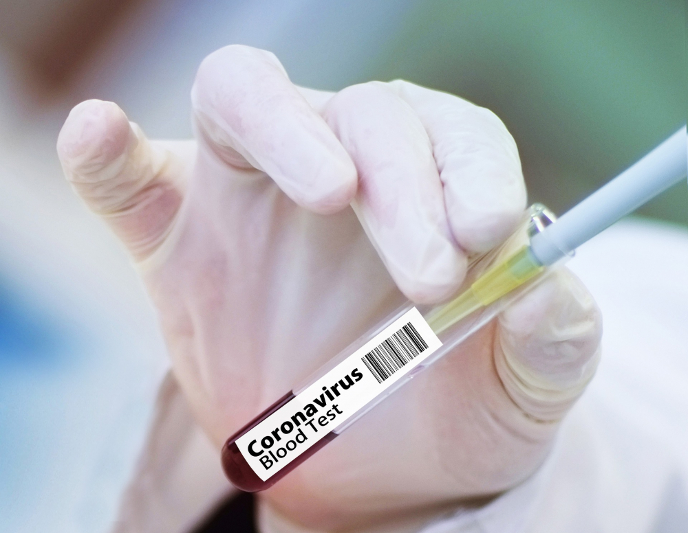 Учени от Оксфорд съобщиха страхотна новина за ваксината срещу COVID-19