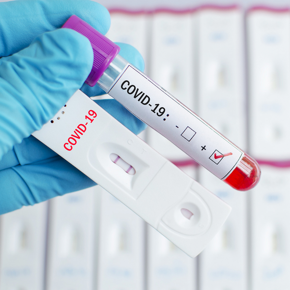 Центърът за контрол на болестите в САЩ с изненадваща новина за PCR тестовете