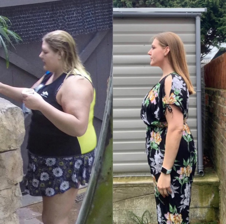 Жена свали 56 кг със своя диета, но гледката под дрехите й е покъртителна СНИМКИ