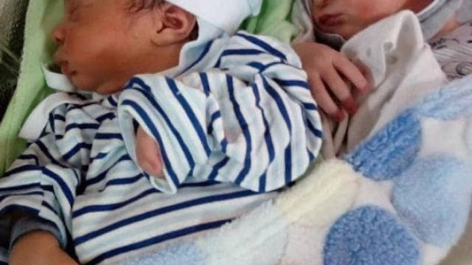 Жена роди близнаци, а лекарите и мъжът й онемяха, щом видяха бебетата СНИМКИ