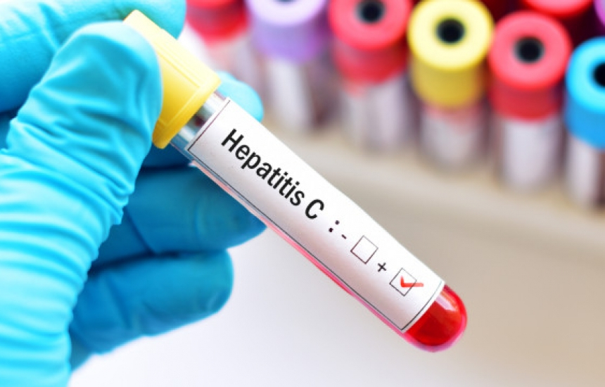 Колко опасен е хепатит С и как се лекува