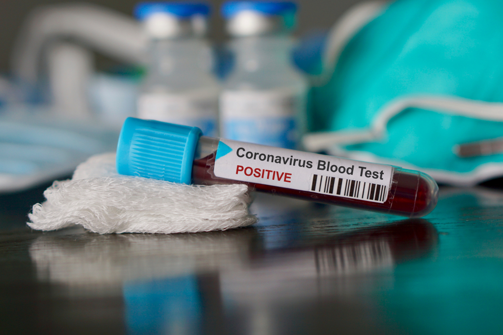 Терапевт изброи 3 необичайни признака на коронавирус