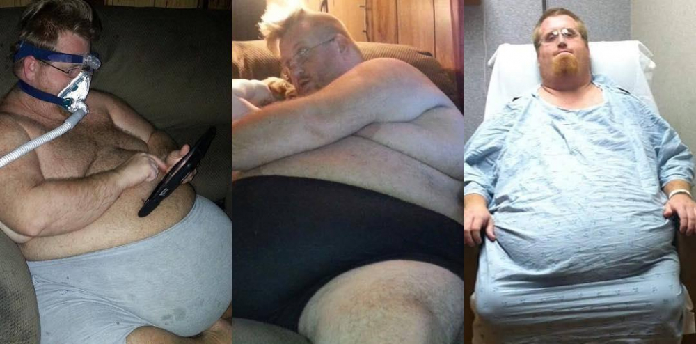 Дебелак отслабна 150 кг само с хранене, ето какво му се случи СНИМКИ