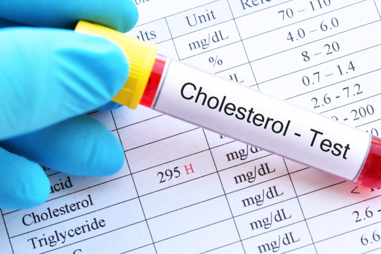 Рядка болест води до висок холестерол, а симптомите са...