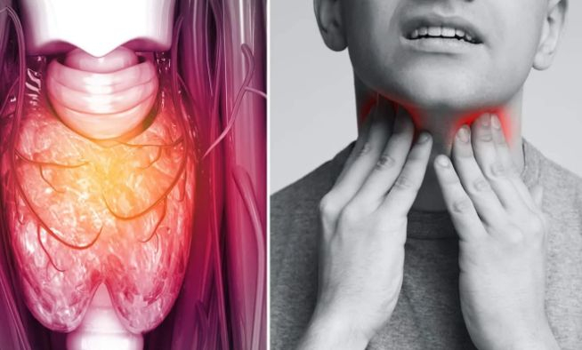 10 признака за рак на гърлото, които не трябва да се игнорират
