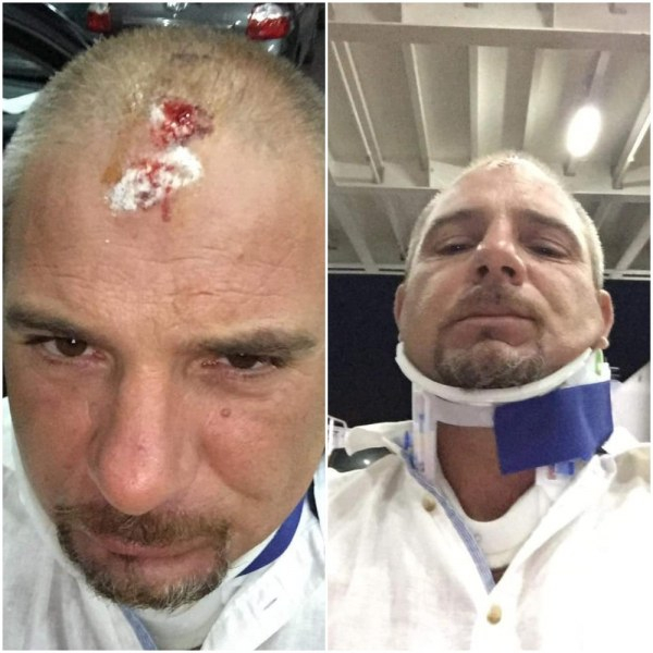 Българин си разби главата на Тасос и ето какво му се случи в болница в Кавала СНИМКИ 