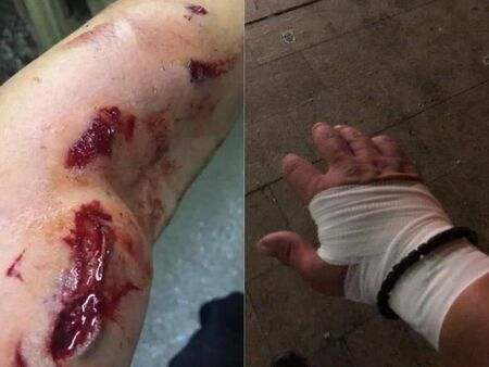 С кървави СНИМКИ 18+ на ранени полицаи попитаха метежниците и Радев: Това ли е мирен протест?! 
