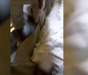 Зловещо ВИДЕО 18+ от болницата в Ямбол с тялото на полумъртъв мъж в мушама взриви мрежата