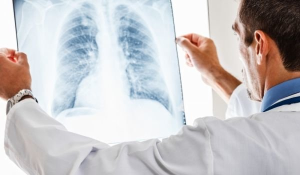 Руски пулмолог огласи тревожни сигнали за проблем с белите дробове