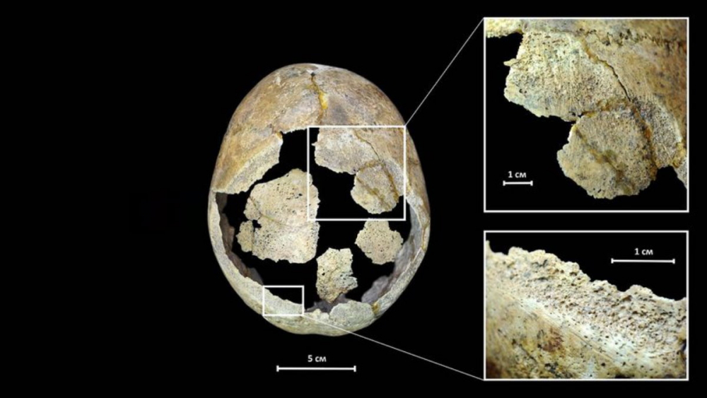 Изумително: Археолози откриха череп на 5000 години със следи от операция на мозъка