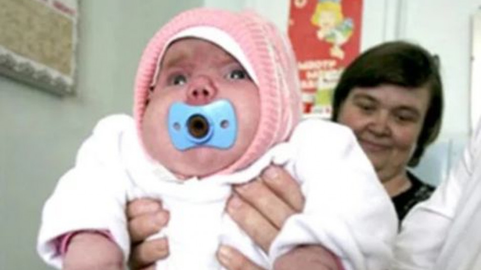 Това 8-килограмово бебе шокира всички, а 13 години по-късно...  
