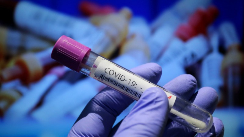 Неочаквано откриване на антитела обръща версията за COVID-19 в Италия