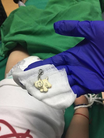 Пазарджишки лекари разрязаха гърлото на 2-г. дете и извадиха нещо шокиращо СНИМКА 18+