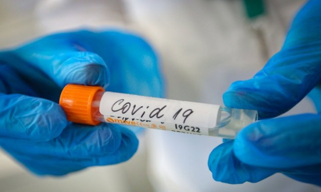 Оповестиха най-страшните данни за COVID-19 по света от началото на пандемията 