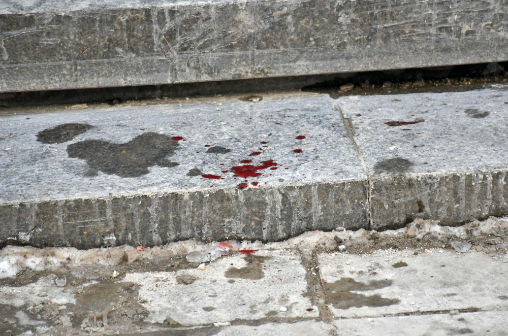 Опасно кървав инцидент в центъра на София! СНИМКИ 18+