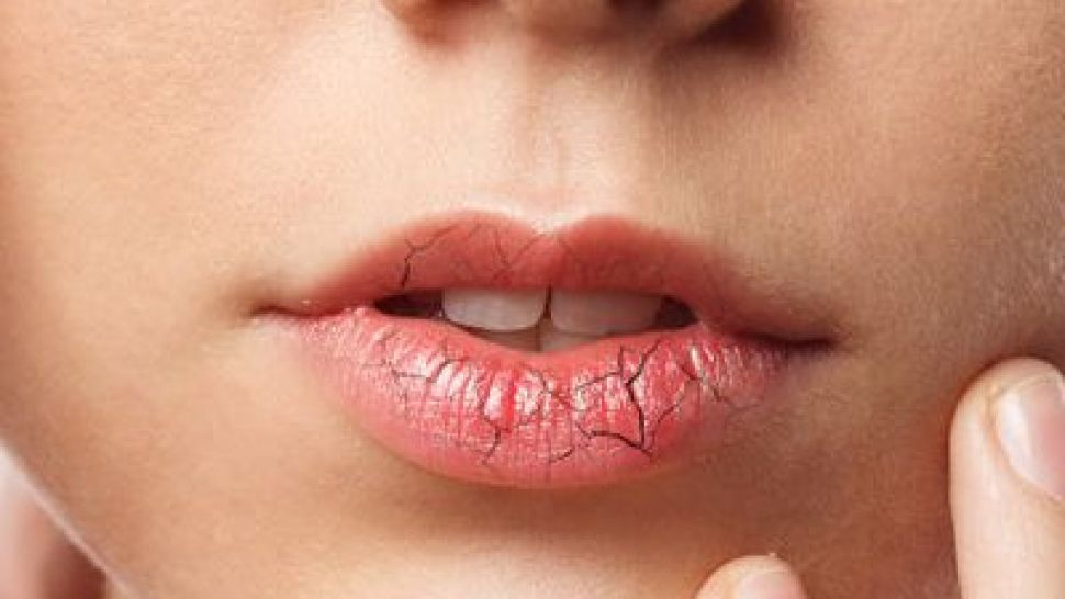 Онколог изброи симптомите за рак на устната кухина