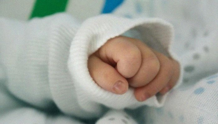 Бебе с две глави проплака в частна болница СНИМКИ 