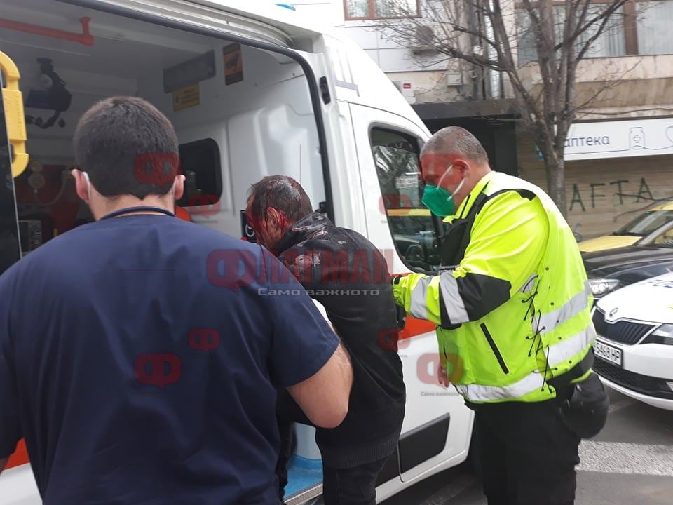 Ужасна гледка в Бургас: Мъж с окървавена глава седи пред Водната палата СНИМКИ