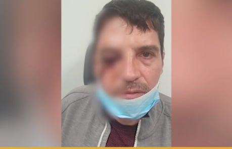 Маскирани пребиха с чукове мъж в центъра на София посред бял ден ВИДЕО