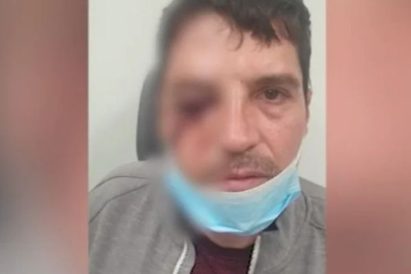 Извънредни новини, след като маскирани пребиха с чукове мъж в центъра на София