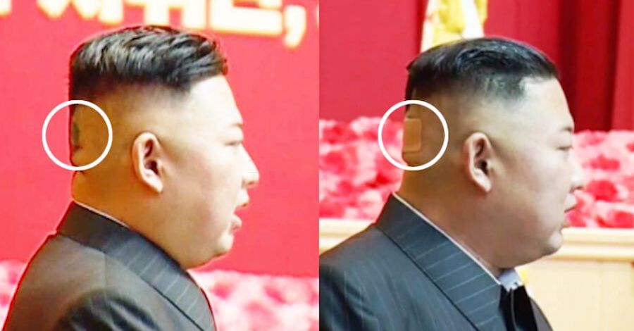 КНДР изтръпна! Каква е тази мистериозна рана на главата на Ким Чен Ун СНИМКИ