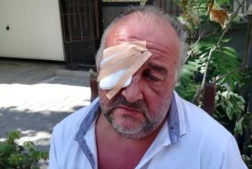 Зверство: Непознати смляха от бой с бокс и електрошокова палка оперен певец в столицата