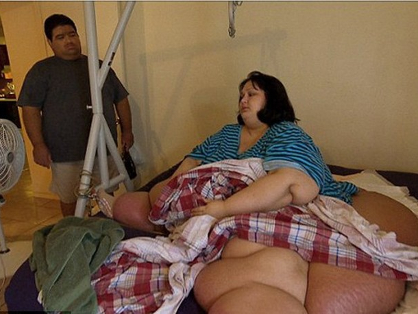 Вижте как изглежда най-дебелата жена в света, свалила е 408 килограма СНИМКИ