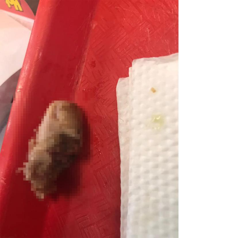 Жена откри човешки пръст във великолепния си бургер СНИМКИ 18+