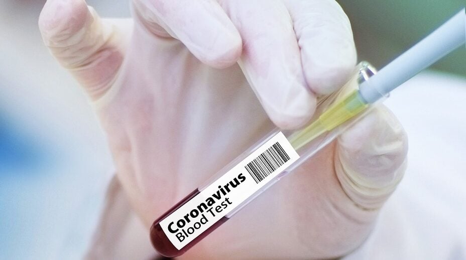 Нова ваксина срещу коронавирус може да се наложи през 2022 г.