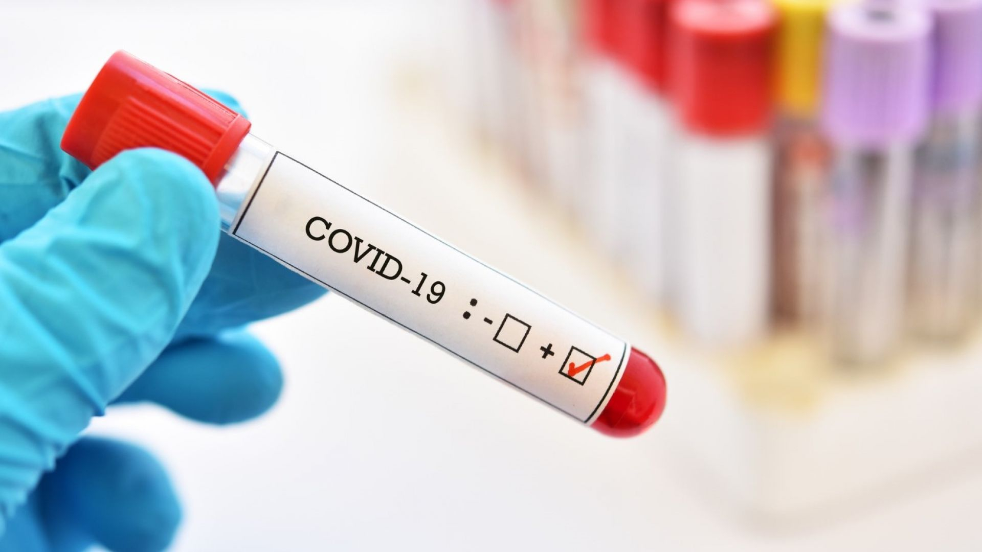 Проф. Аврамов: Озонотерапията и високите дози витамин C са радикално лечение на коронавирус