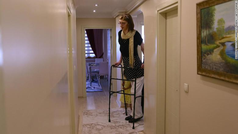 В Турция живее най-високата жена на планетата СНИМКИ