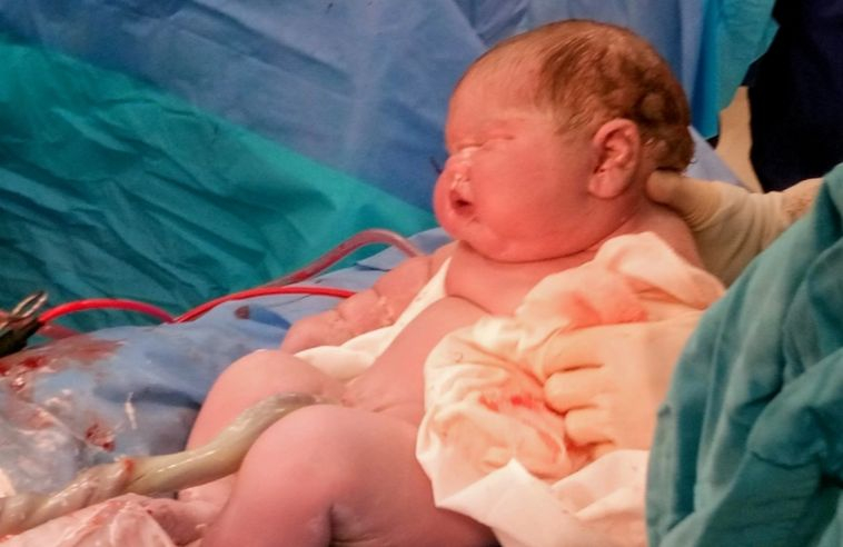 Майка със спирала ошашави лекарите с гигантското си бебе СНИМКИ 