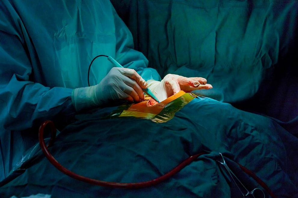 Пробив: Трансплантираха ГМО бъбреци от прасе на мъж в мозъчна смърт СНИМКИ 18+