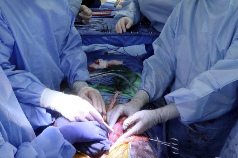 Пробив: Трансплантираха ГМО бъбреци от прасе на мъж в мозъчна смърт СНИМКИ 18+