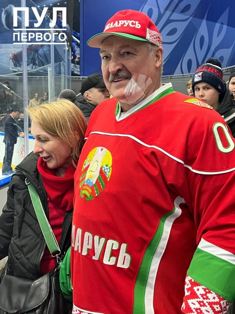 Окървавиха Александър Лукашенко, наложи се да го шият ВИДЕО
