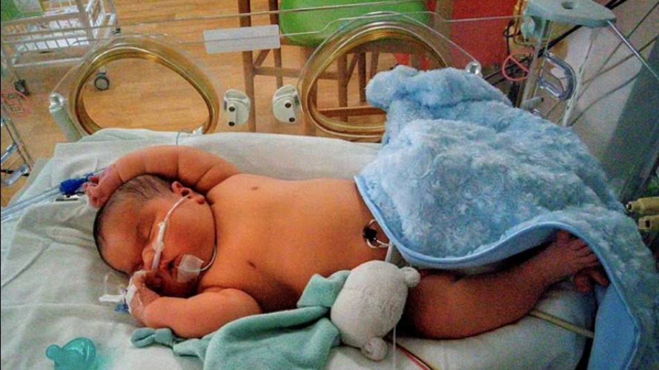 Когато се роди, това бебе тежеше близо 7 кг, а 5 месеца по-късно... 