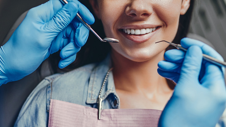 Какви услуги ми се полагат по Здравна каса в стоматологията?